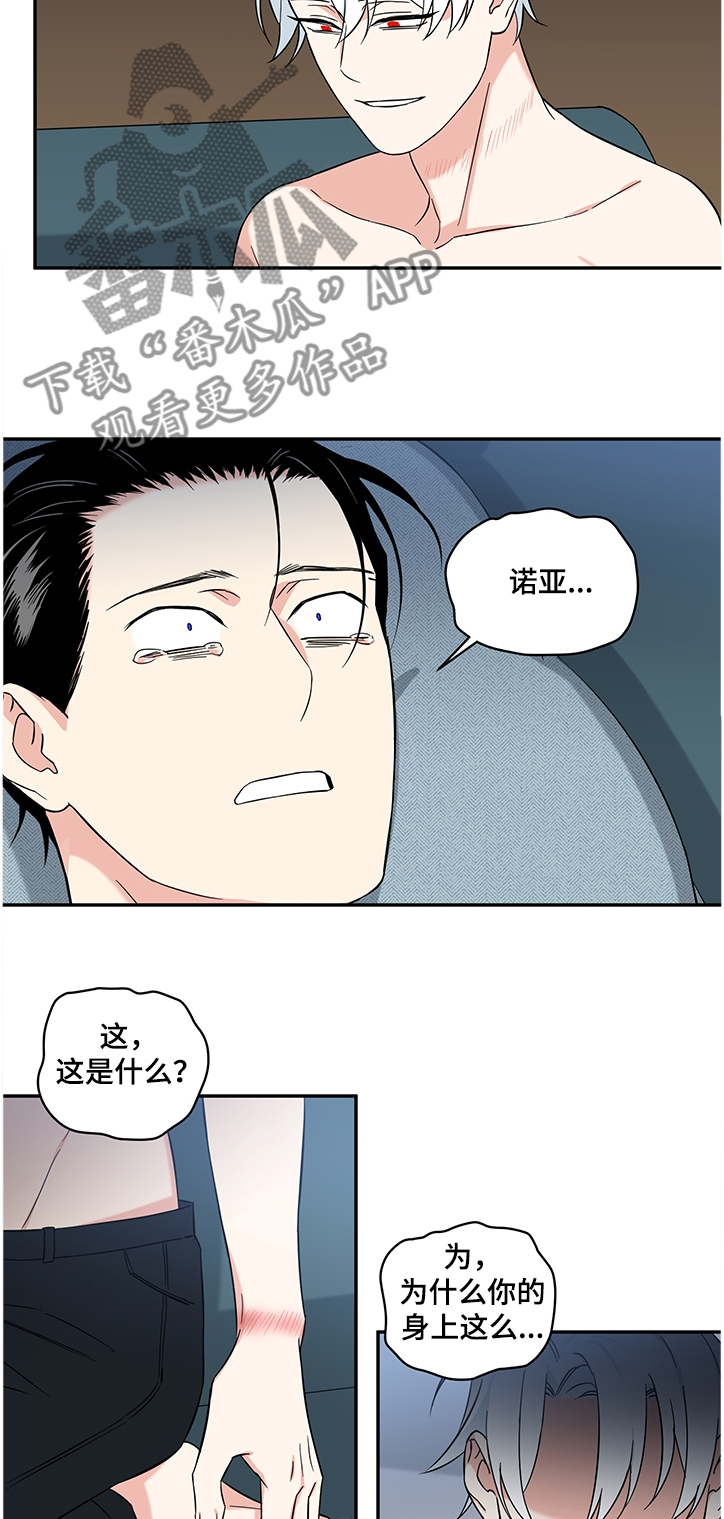 面瘫英雄漫画,第99章：【后记】伤痕1图