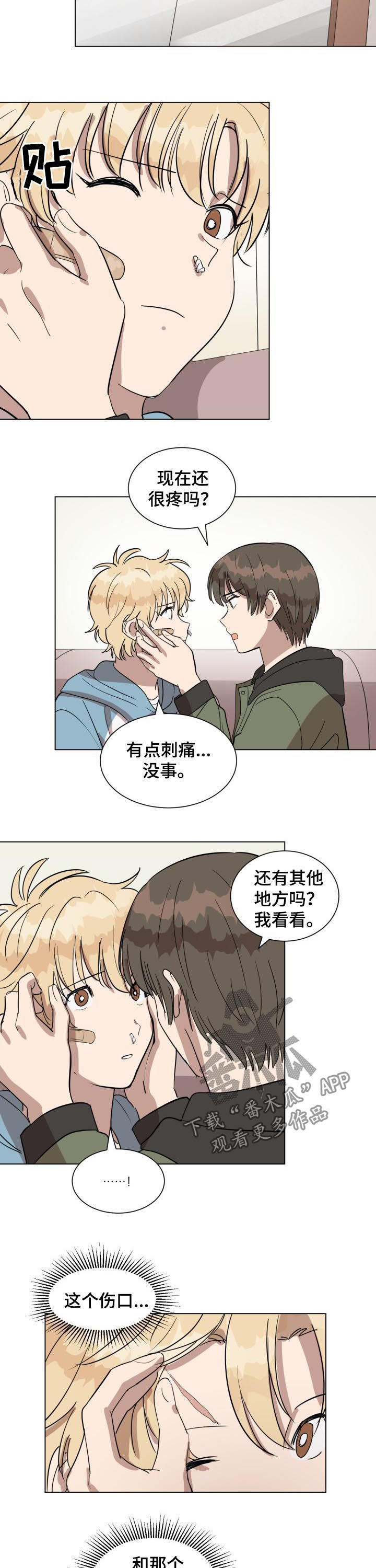 美丽的误会直播漫画,第23章：伤口2图