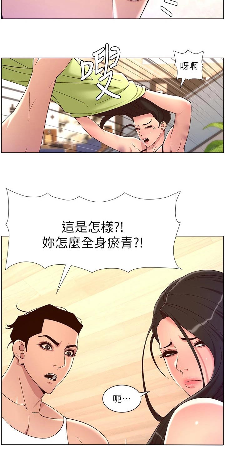 帝王软件是什么漫画,第52章：淤青1图