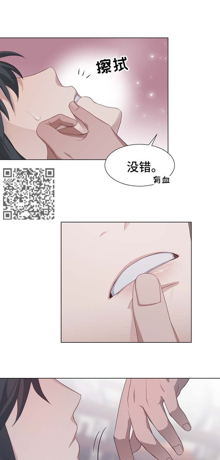 灵魂置换漫画,第38章：受损1图