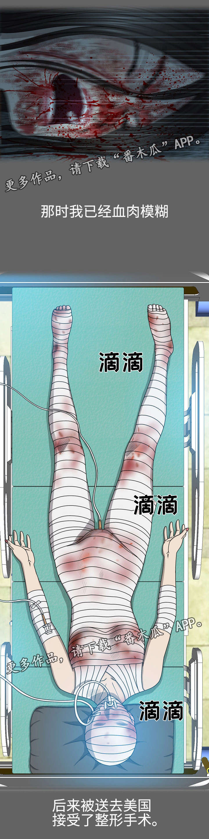整形交换漫画,第50章：会没命的1图